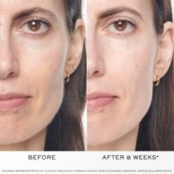 Lancome Lancôme - Renergie M Lift Ultra Triple Serum 50ml Lancôme Renergie M Lift Ultra Triple Serum 50ml -Liquor Magasin 5074180 5 en GB